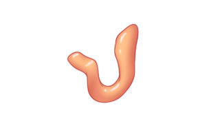 The tragus–antitragus complex is a challenging three-dimensional entity that has convexities and concavities. The intertragal notch is the thinnest portion.