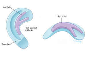 The antihelix is first to be placed on the baseplate.