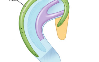 The helix is then secured with steel sutures.