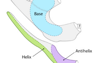 The typical plan for the harvested cartilage for microtia reconstruction of the left ear: The floating eighth rib often serves as the helical rim and, when robust, can also be used for the antihelix. The synchondrosis of the sixth and seventh ribs often provides the base plate. Extra pieces of cartilage serve to become the P1 (Projection 1) piece as described by Dr. Firmin, and banked pieces for the elevation of the ear in the second stage. Banked cartilage pieces are placed in a pocket of the subcutaneous skin of the chest closure secured to the dermis.