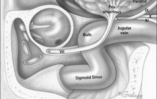 Anatomy of the jugular foramen: lateral perspective.