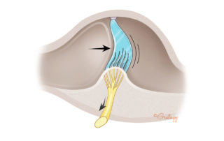 Cupula bowing with endolymph motion.