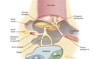 Middle ear and inner ear vestibule from inferior perspective. The facial recess and sinus tympani are important in chronic ear surgery.