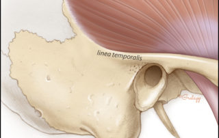 The relationship between the temporalis muscle and the linea temporalis.