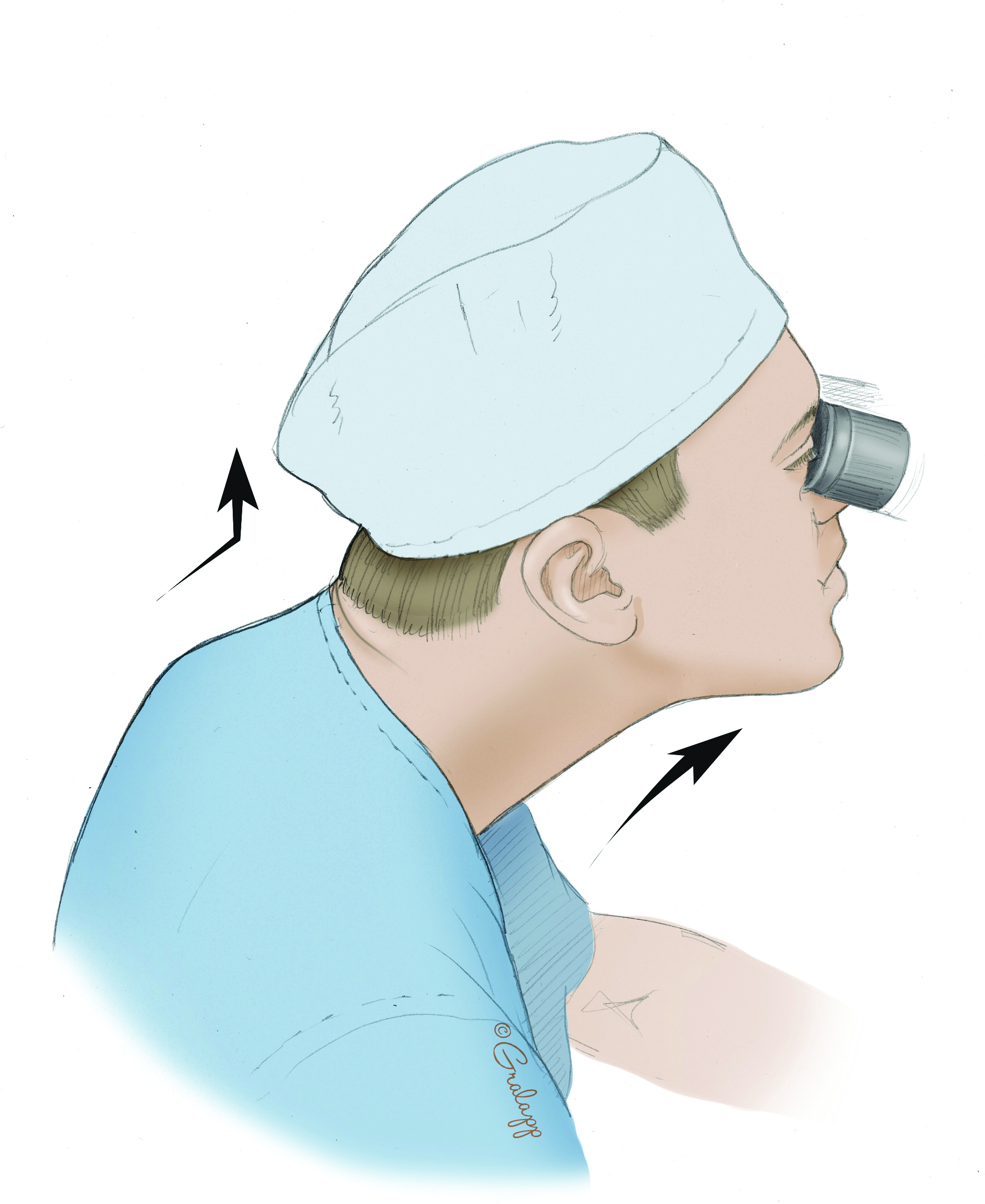 It is often tempting to lean into the microscope optics which results in uncomfortable neck extension and forward thrust. It is often tempting to lean into the microscope optics which results in uncomfortable neck extension and forward thrust.
