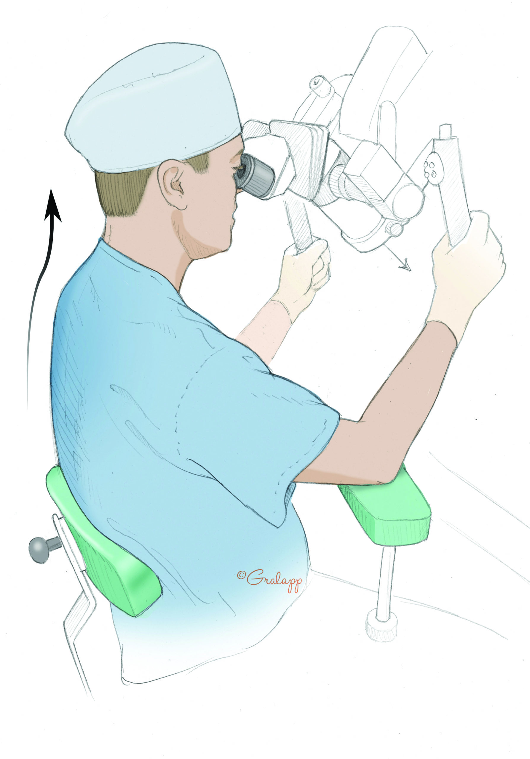 Microsurgeons are also prone to cervical spine problems. Maintaining a neutral neck position when using a microscope reduces strain on the surgeon’s neck. Microsurgeons are also prone to cervical spine problems. Maintaining a neutral neck position when using a microscope reduces strain on the surgeon’s neck.