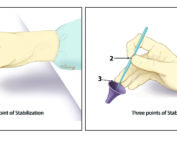 Incorrect hand position for ear microsurgery, which is less stable and limits visibility. The correct hand position has three-point stabilization.