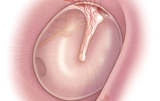 The vascular strip in the posterior-superior ear canal provides blood supply to the central portion of the tympanic membrane. The vascular strip in the posterior-superior ear canal provides blood supply to the central portion of the tympanic membrane.