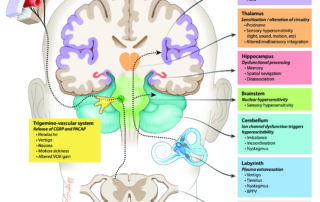 Vestibular Migraine Syndromes