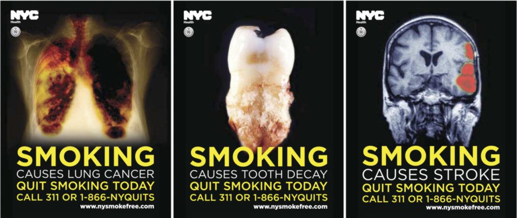 Lung Disease – img13237