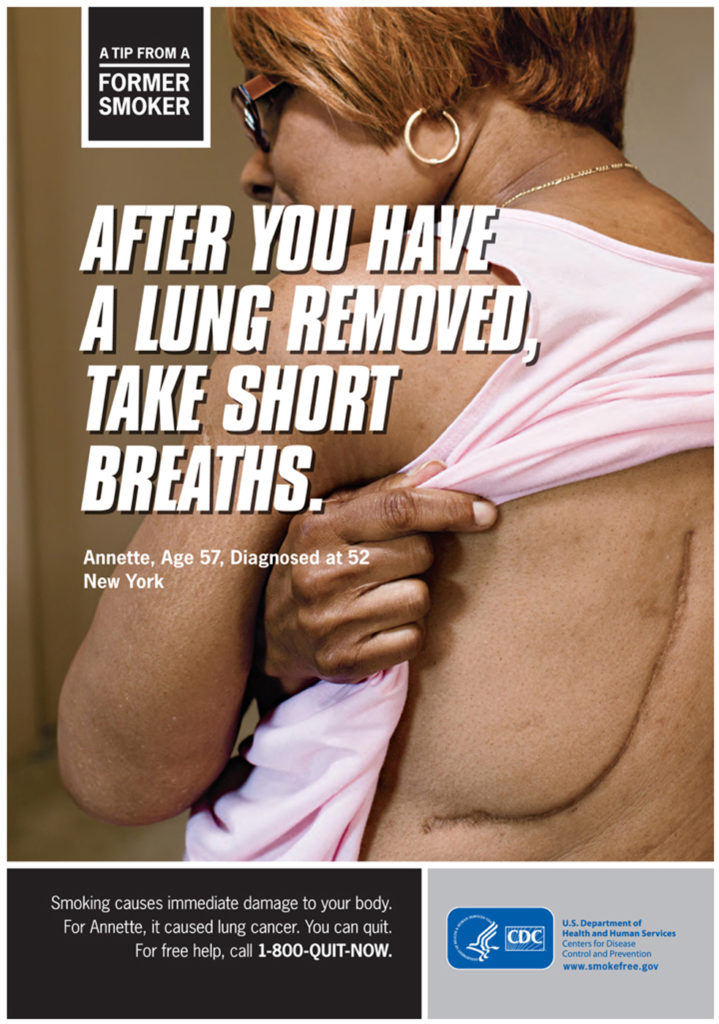 Lung Disease – img13722