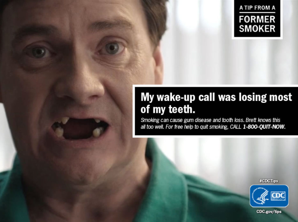 Mouth & Throat – img13737