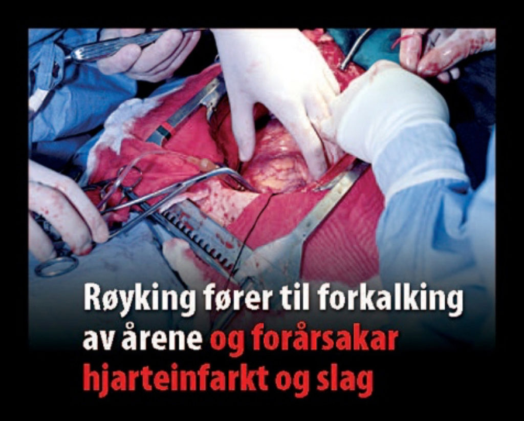 Norway – img14798
