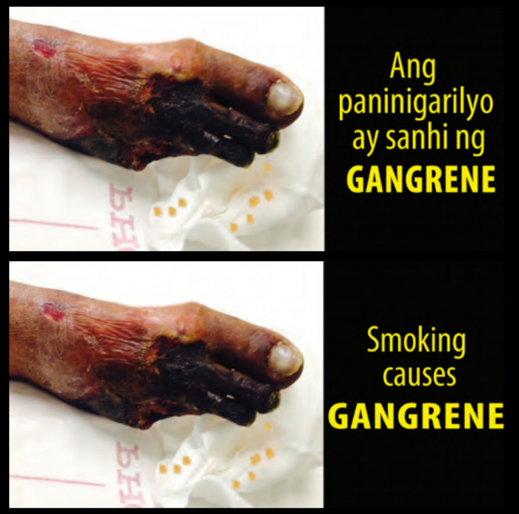 Philippines – img14805