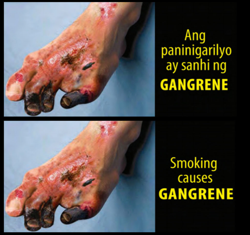 Philippines – img14806