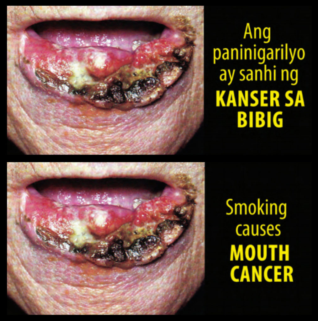 Philippines – img14808