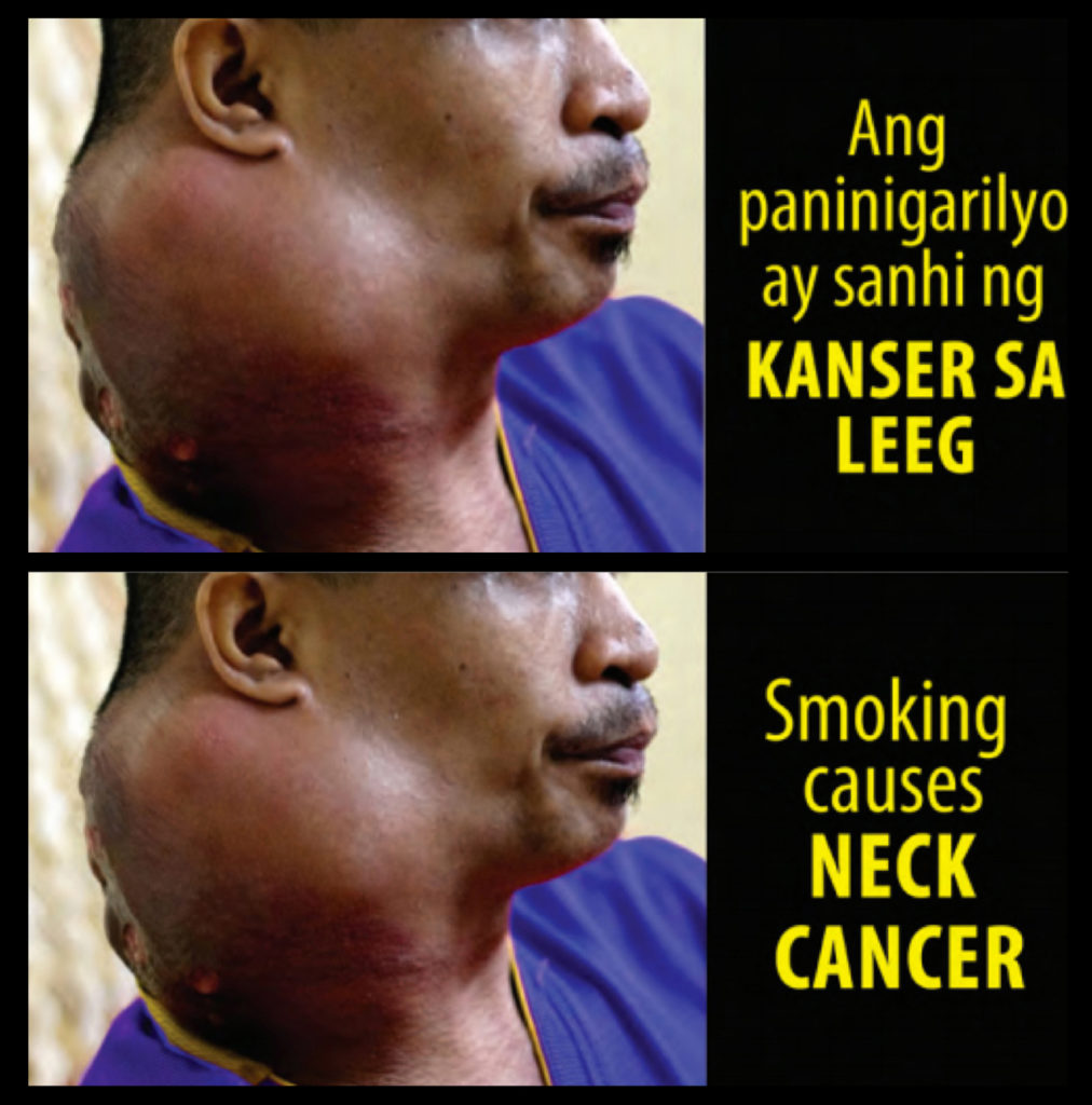 Philippines – img14809