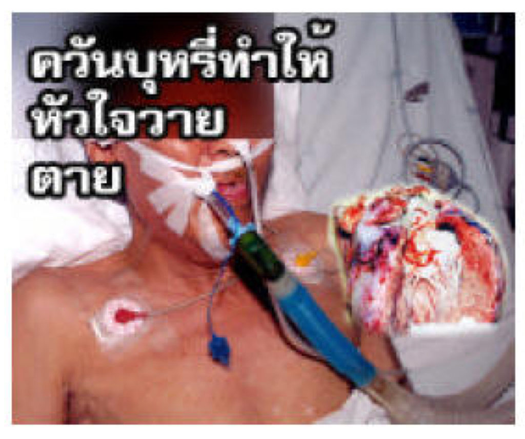 Thailand – img14829