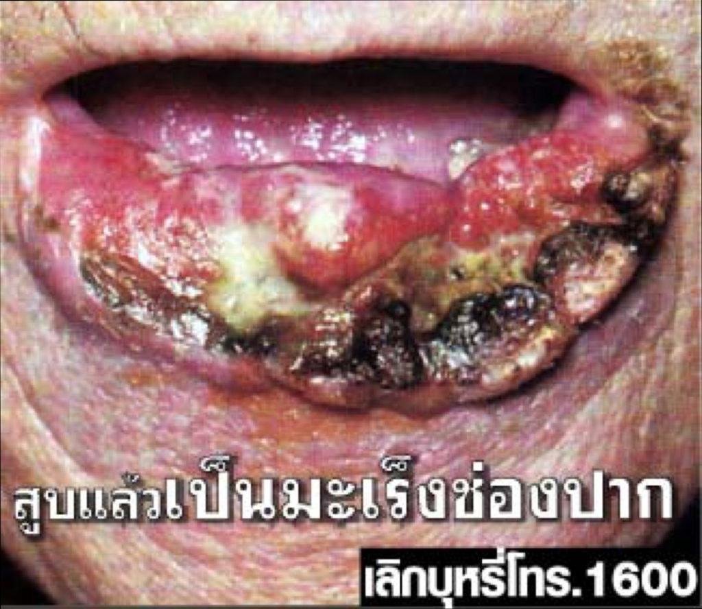 Thailand – img14825