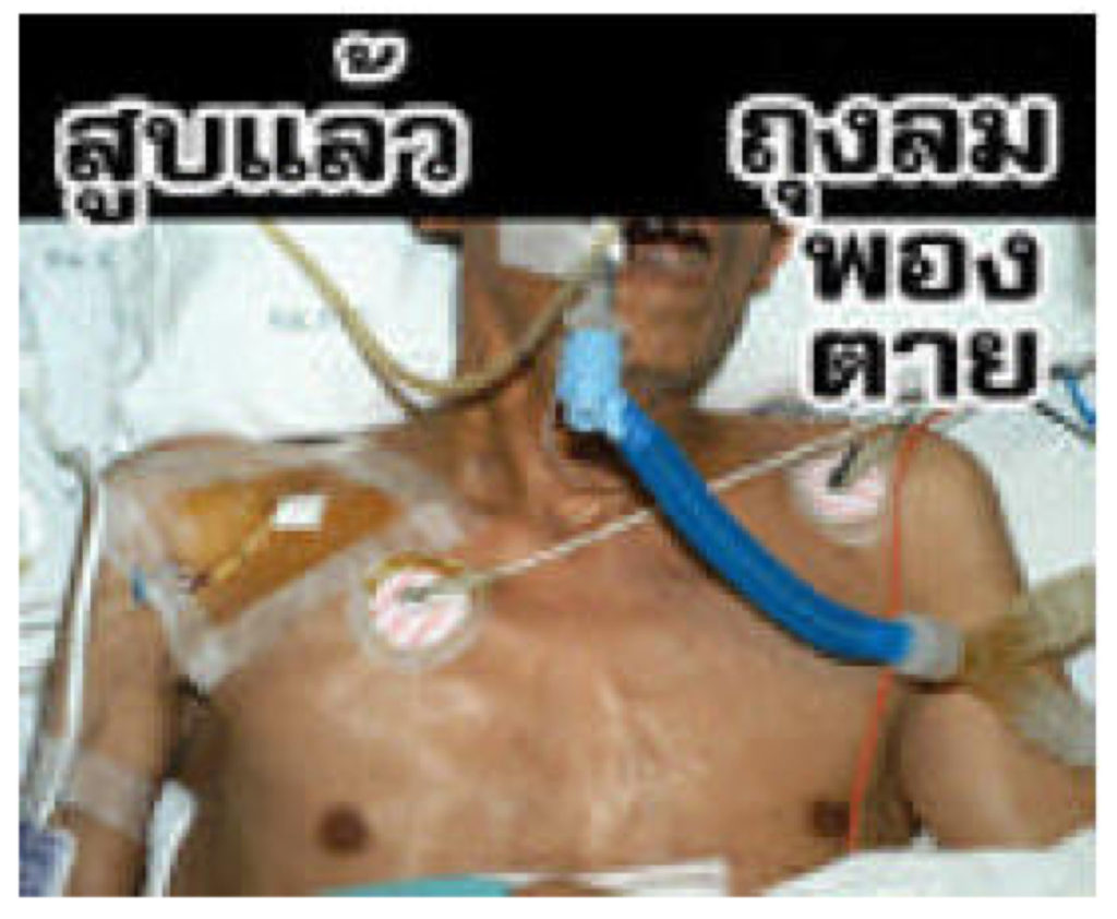 Thailand – img14828