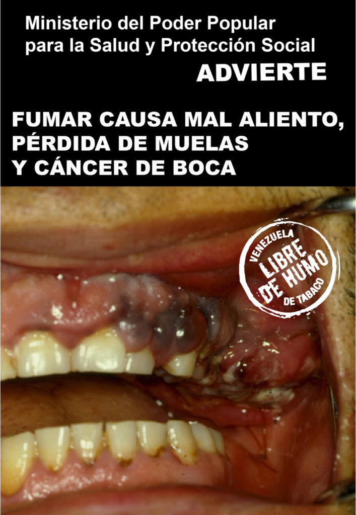 Venezuela – img14882
