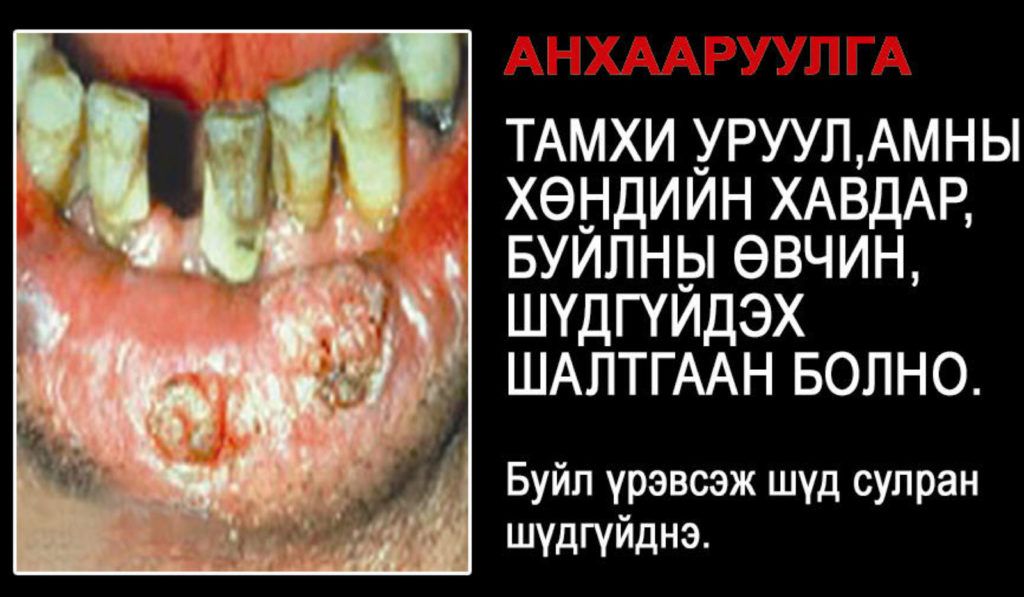 WHO – img14748