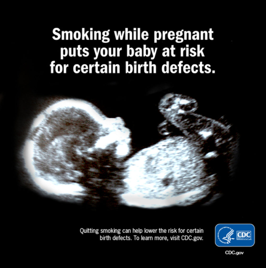 Fumes for Fetus – img14694